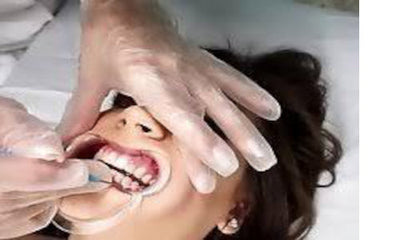 BDSM 101: Dentalspielfetisch